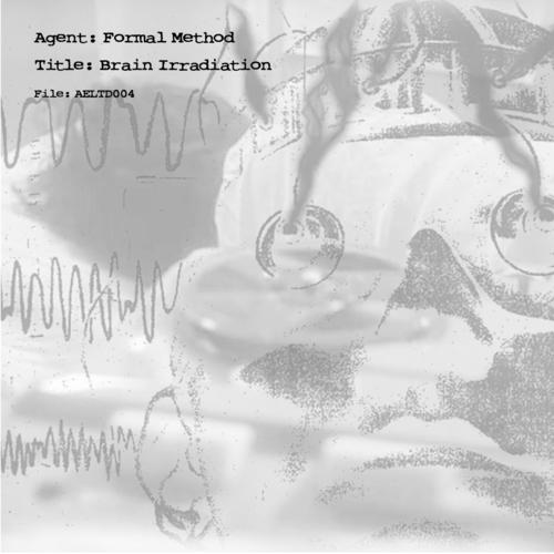 AELTD004 Brain Irradiation